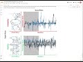 Statistical Rethinking (2nd Ed), Solutions to Problems 9E6-9E7 | Trace Plots and Trank Plots