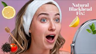 8 Natural Ways to Remove Blackheads Fast – No Harsh Chemicals!