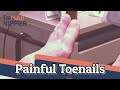 Uncomfortable Toenails.  How painful nails?  (2021)