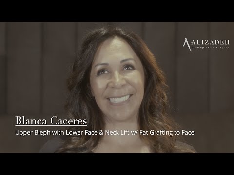 Facelift Patient Testimonial | Dr. Alizadeh Cosmoplastic Surgery