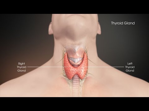 Video: Multinodular Goiter: Penyebab, Pengobatan, Komplikasi, Dan Banyak Lagi