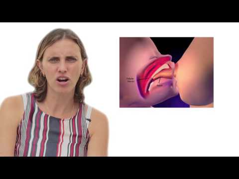 Video: ¿Cómo dejar de sentir pellizcos durante la lactancia?