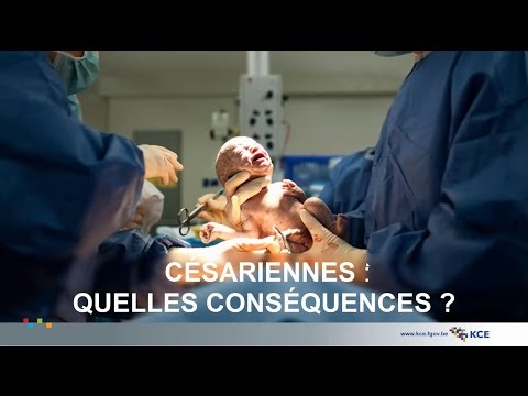 Vidéo: 10 Mythes Sur La Césarienne