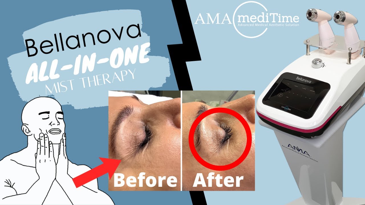 Bellanova AllInOne Nano Mist Therapy System YouTube