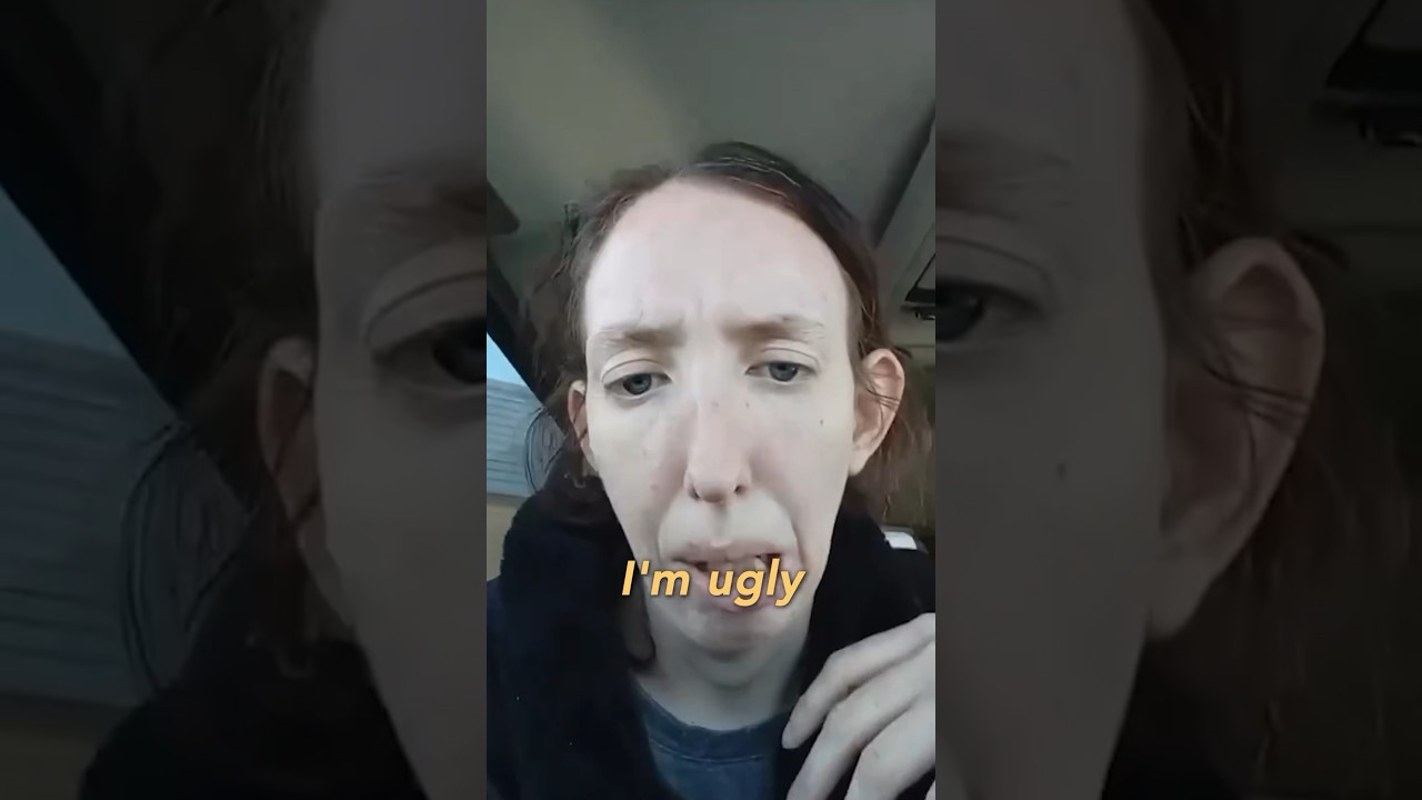 Internet Calls Her ‘Ugly’ but God Calls Her…🙏🏻