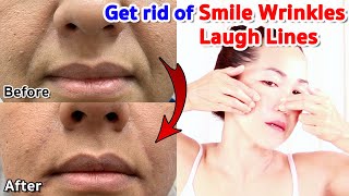 Get rid of Smile Wrinkles, Laugh lines, Nasolabial folds | NO TALKING | Facial Massage