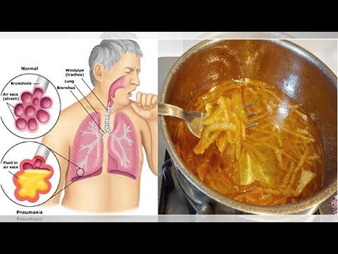 「橘子皮」比味苦感冒藥更有效：在家這樣煮，止咳化痰又防寒，大小孩都愛吃，不用再怕久咳不止！ | Karl Channel
