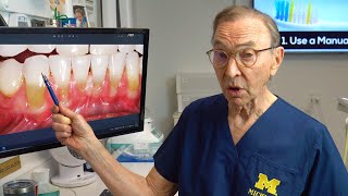 Gum Recession Treatment- AMAZING RESULTS! The Pinhole Technique