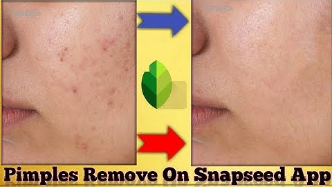 How To Remove Pimples and Smooth Skin In Snapseed App Tutorial 🎨🖌️