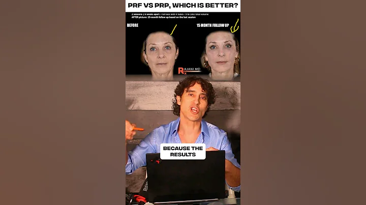 Prp Vs PRF - Look Years Younger Than Your Age