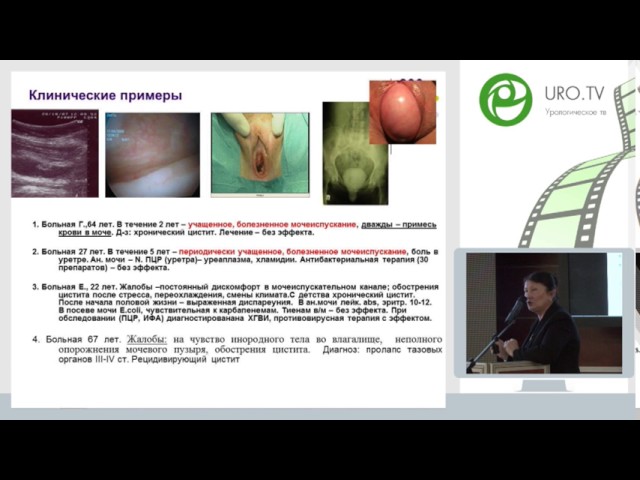 Синякова Л А - Ошибки консервативной терапии острого и рецидивирующего цистита