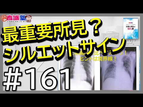 診療の補助の強化書 動画 出直し看護塾（診療の補助の強化書＋ケーススタディ＋