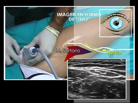 Video: Anatomia, Funzione E Diagramma Del Nervo Cutaneo Laterale Laterale - Body Maps