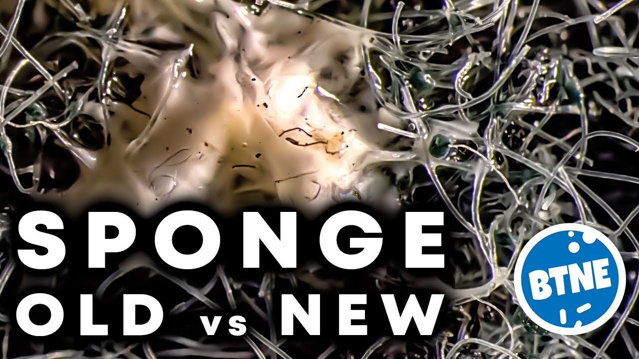 Old Vs New Kitchen Sponge Under The Microscope YouTube