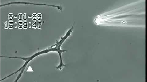 Why Cleanse Mercury Causes Brain Neuron Damage   Call Linda