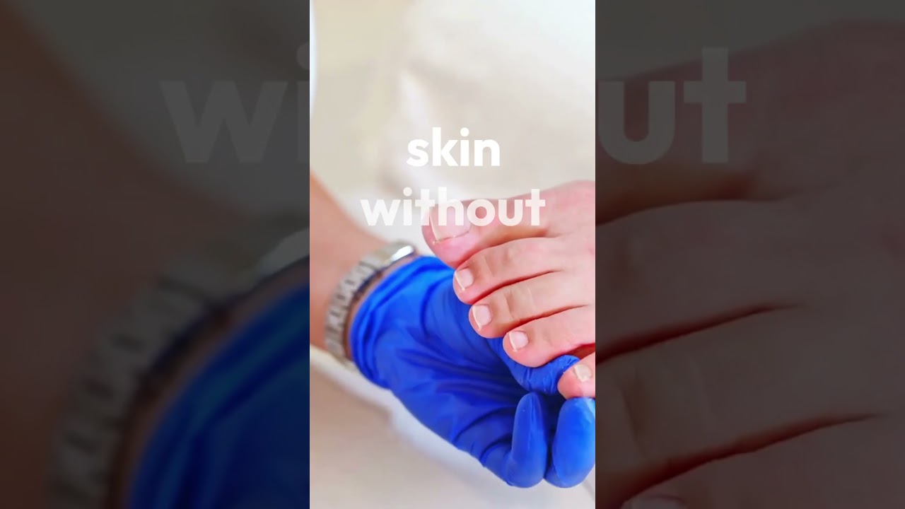 “Kerassentials – The Secret to Perfect Nails & Skin? Watch Before Buying!”#nailfungus