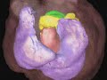 5-D Imaging of the Heart
