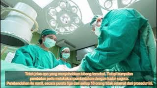 Cerita Mission Advent 14 Januari 2023