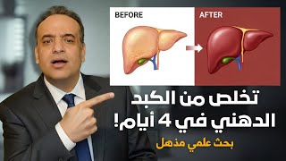 تخلص من الكبد الدهني ومقاومة الأنسولين في اربع ايام | بحث علمي يقلب الموازين