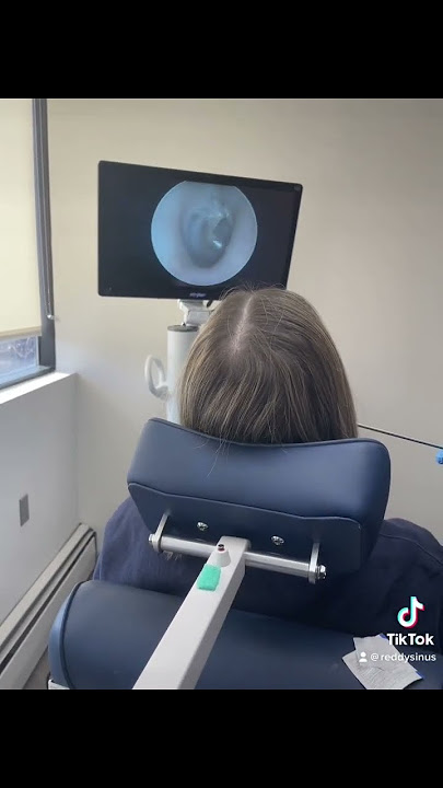 What a normal ear drum looks like vs a retracted ear drum
