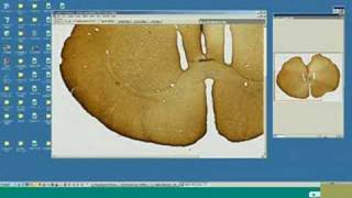 Trial Video For Pathscan Iv From Meyer Instruments