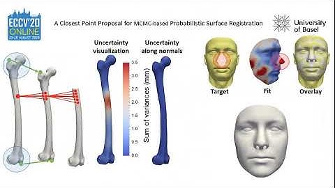 A Closest Point Proposal for MCMC-based Probabilistic Surface Registration (ECCV2020 - Poster)