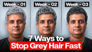 Stop Hair Greying in 30 Days (Dermatologist Explains) Reverse Gray Hair By Doctor Thakur