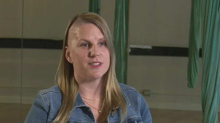 Raising awareness after a brain tumor turned a woman's life upside-down