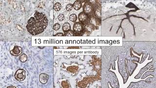 Human Proteome webinar on 18 March 2015