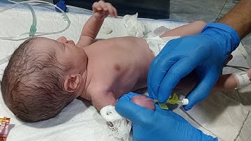  Newborn Baby IV Line Protocol | NICU Therapeutic Care by Male Nurse | Full Procedure