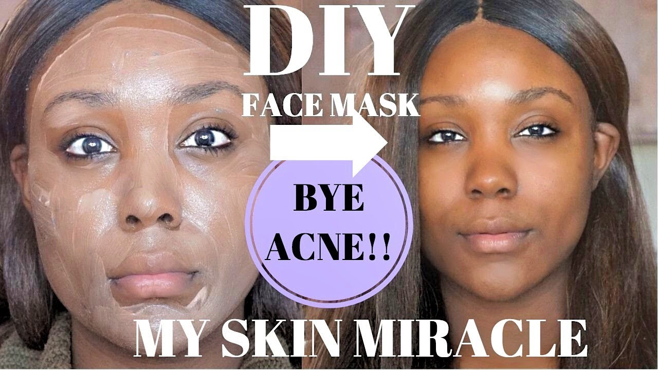 OILY SKIN ACNE CHEAP SKIN CARE ROUTINE REMOVE ACNE DARK SPOTS CLEAR 