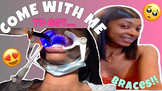 COME WITH ME TO GET BRACES + Spacers!! | Vlog | Did they hurt?!?