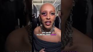 Doja Cat’s Chaotic Rise to Fame 😈||#dojacat #celebritygossip #hollywood