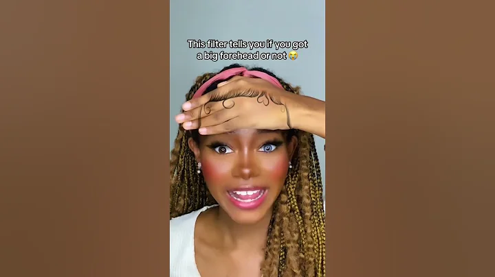 I have a big forehead 😢