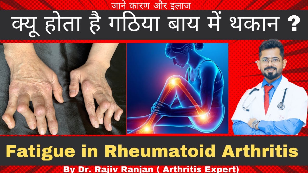 गठिया बाय में सुस्ती ? Fatigue in Rheumatoid Arthritis RA Fatigue