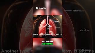 Asthma vs  Allergies  Understanding the Differences