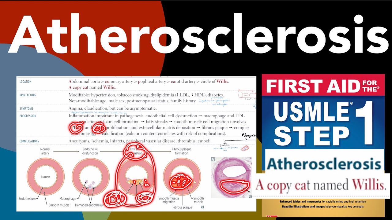Atherosclerosis in Hindi/Urdu by first aid for USMLE step 1 - YouTube