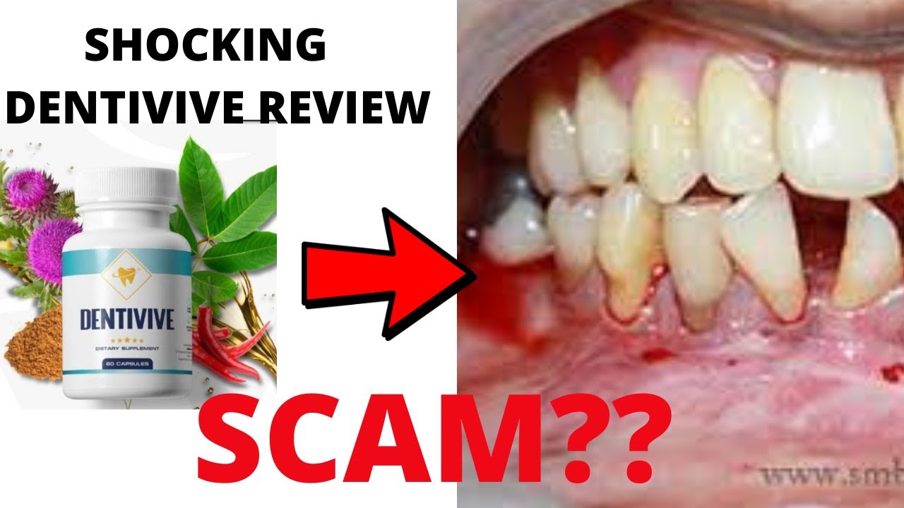 Dentivive Dietary Supplement Reviews-DOES IT WORK? OR ANOTHER SCAM???