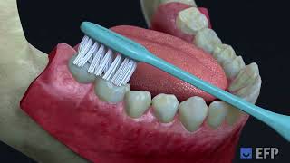 Gum Health Day 2023: Spyros Vassilopoulos shows the bass tooth brushing technique