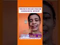 Ela Melhorou a Circulação Sanguínea da sua Paciente! #cursoreflexologia