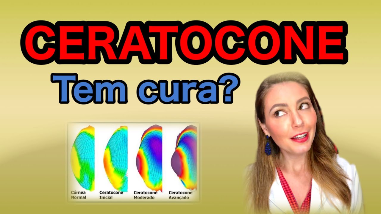CERATOCONE tem cura? Saiba sobre o CROSSLINKING do colágeno e anime-se!