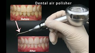 Dental air polisher teeth cleaning air flow air prophy jet handpiece dentist airflow polisher