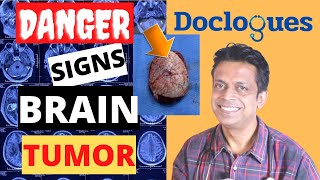 Danger Signs of a Brain Tumor