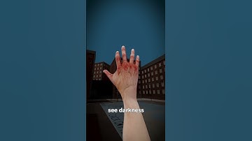 Thumbnail of What Would You See With No Eyes? 😳