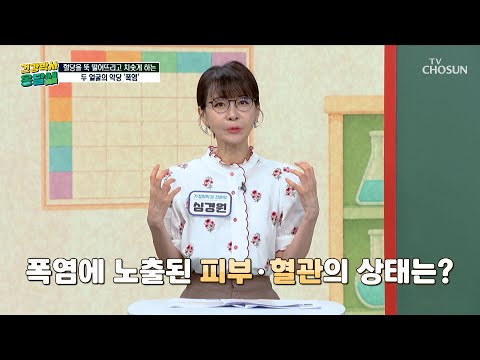 폭염으로 인한 혈관 비상사태💥 당뇨 환자에게 더욱 치명적인 여름철 더위🥵♨ TV CHOSUN 260810 방송 | [건강박사 옹달쌤] 33회 | TV조선