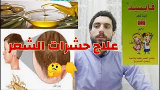 التخلص من جميع انواع حشرات الشعر #والقمل_والسبان ب10جنيه بس