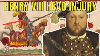 Did a HEAD INJURY turn Henry VIII into a TYRANT?