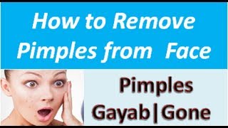 How to remove pimples from face in 2 minutes[Hindi]|पिम्पल्स कैसे हटाए? screenshot 2