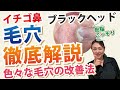 【プロが解説!】毛穴の種類と改善方法!これであなたも毛穴の悩みから解放!