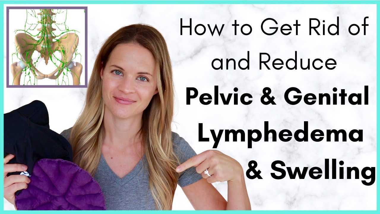 How to Get Rid of Pelvic or Genital Swelling- Treatment Options